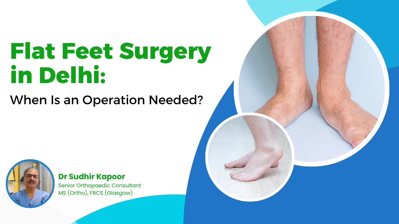 Flat Feet Surgery in Delhi